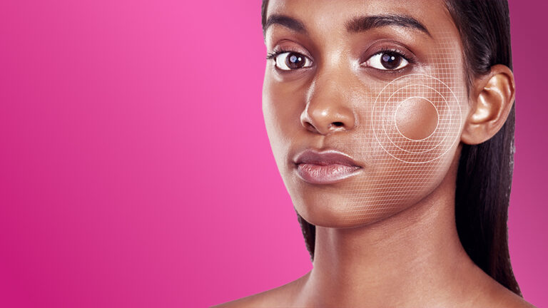 La précision de la Skin Tech en IA est-elle supérieure à celle des questionnaires ?