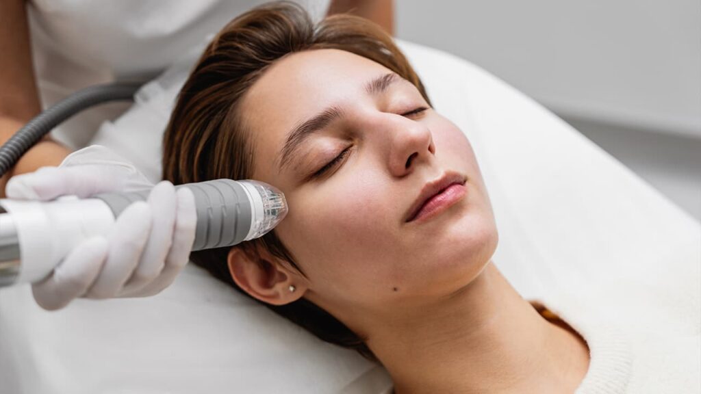 Les avantages du microneedling ou thérapie d’induction de collagène