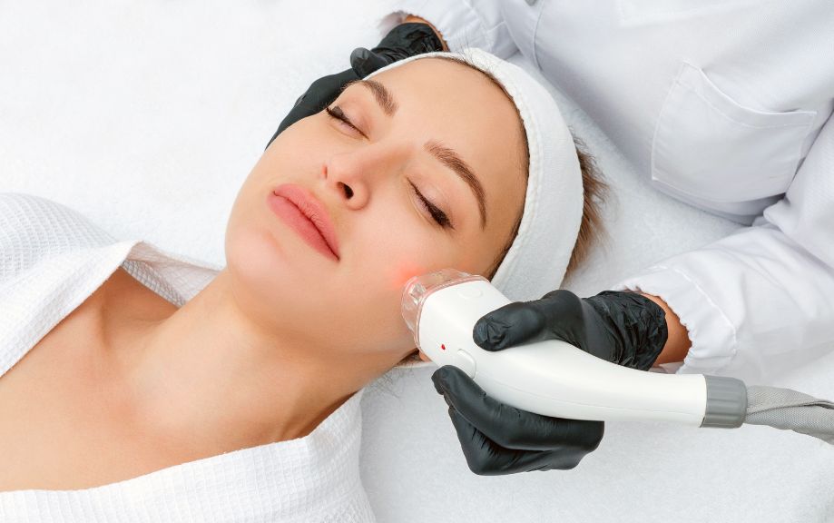 Les traitements au laser pour une peau éclatante sans chirurgie