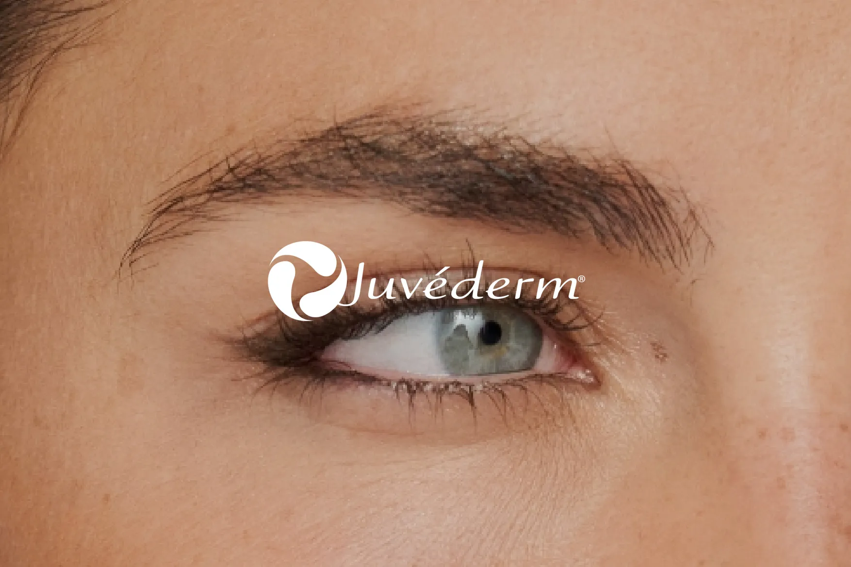 karma medical & beauty juvederm